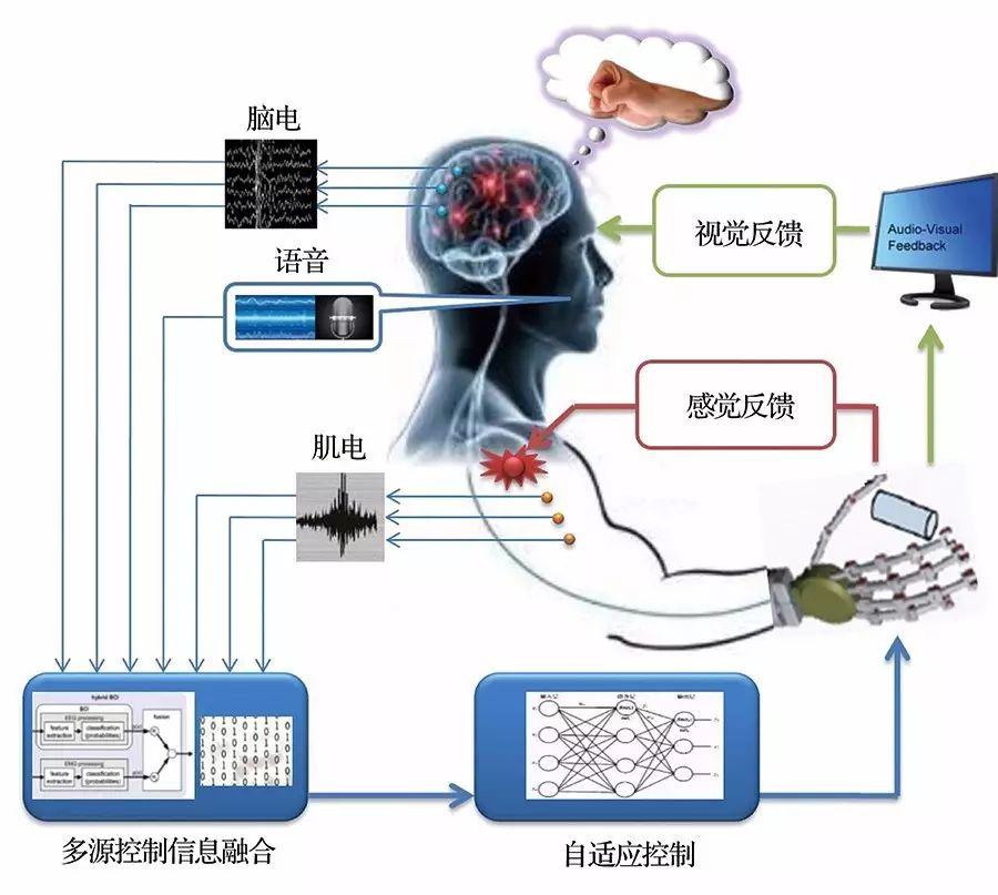 神经控制多功能假肢为截肢者带来希望 技术阅读 半导体技术